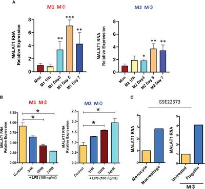 LncRNA MALAT1/microRNA-30b axis regulates macrophage polarization and function